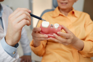 Closeup of unrecognizable dentist pointing at tooth model while explaining dental implant surgery to patient in clinic, discussing the dental implant treatment process.  