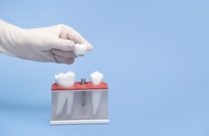 A hand in a white glove holds a model of a tooth implant blue table and background.